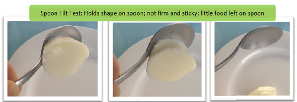 A series of photographs illustrating how to do the spoon tilt test
